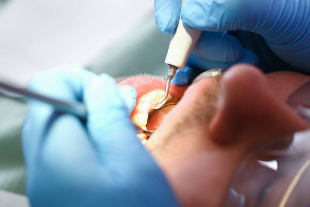 Best Urgent Tooth Repair  in New Bremen, OH