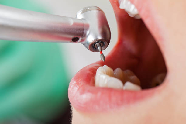Best Emergency Gum Pain Relief  in New Bremen, OH